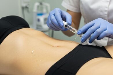 Carboxiterapia